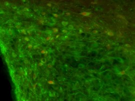 Angiotensinogenio PVN