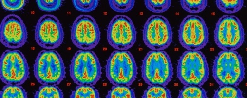 foto retrospectiva.jpg